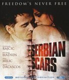 Serbian Scars (Blu-ray), Brent Huff